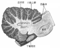 右侧延髓和小脑矢切面，下橄榄也被切开。