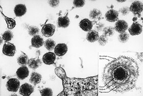 Micrografia eletrônica de uma das espécies HHV6