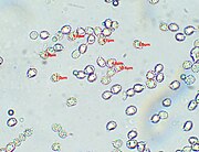 Spores