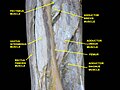 Muscles of Thigh. Anterior views.