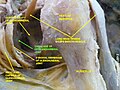 Dissection image of the cartilage of the glenohumeral joint in green