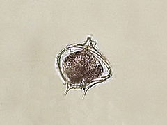 Protoperidinium depressum (Protoperidiniaceae).