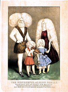 Affiche lithographiée d'un homme, d'une femme et de deux enfants albinos.