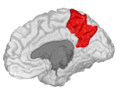 Precuneus of right cerebral hemisphere.