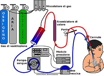 Schema di funzionamento di una macchina ECMO