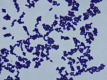 Micrograph showing blue-colored bacteria on a white background