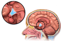 Location of the hypothalamus