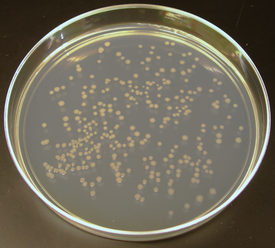 Колонии E. coli на плотной питательной среде