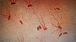 Salmonella enterica serological 변종 Typhi