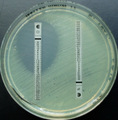 2 etest messi a confronto in coltura di Pseudomonas aeruginosa. Quello a sinistra contiene ciprofloxacina, quello a destra imipenem; si noti il vasto alone di inibizione intorno alla ciprofloxacina.