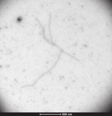 Transmission electron microscopy photograph of Allexivirus