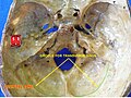 Base of the skull. Upper surface. Groove for transverse sinus labelled at bottom.