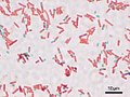 Imagen microscópica de la formación de esporas bacterianas de Bacillus subtilis (ATCC 6633) Coloración de esporas, ampliación: 1.000. (verde) esporas, (rojo) estado vegetativo.