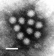 Norovírus em microscopia de transmissão