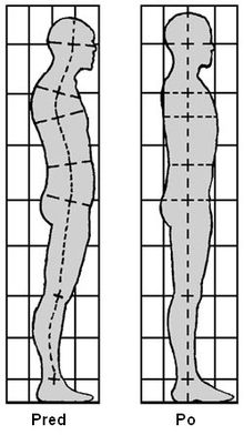 Two diagrams of a human figure in profile. The one on the left has a hunched posture, whereas the one on the right has an upright posture.