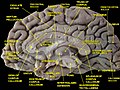 Medial surface of cerebral hemisphere. Medial view. Deep dissection.