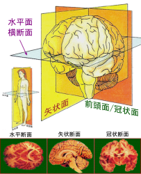 ヒト大脳における平面。