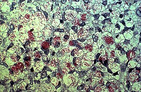 Mycobacterium leprae