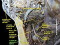 Inferior alveolar nerve