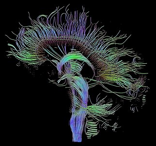 Diffusion MRI, by Thomas Schultz