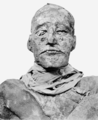 Ramesses III's mummy