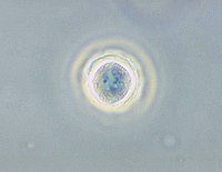 Acanthamoeba polyphag