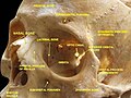 Cranium. Supraorbital foramen.