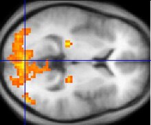 Monochrome fMRI image of a horizontal cross-section of a human brain. A few regions, mostly to the rear, are highlighted in orange and yellow.