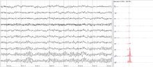 The sample of human EEG with prominent alpha-rhythm in occipital sites