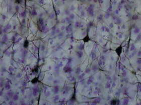 صورة للعصبونات في القشرة المخية كما تظهر بواسطة صبغة غولجي