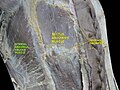 Internal abdominal oblique muscle.Anterior abdominal wall.Deep dissection.Anterior view