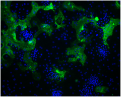 Description de l'image Coronavirus-HKU1.png.