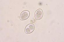 Coccidia oocysts in a fecal flotation from a cat. The cat was underweight and had diarrhea, showing signs of coccidiosis.
