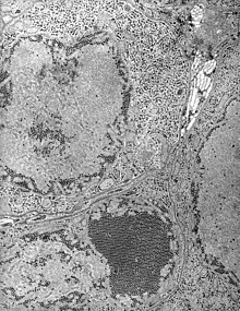 Electron micrograph of "Saint Louis encephalitis virus" seen in a mosquito salivary gland