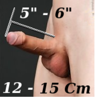 File:Normal erect.tiff