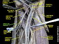 Gracilis muscle