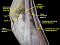 Dorsum of foot. Ankle joint. Deep dissection