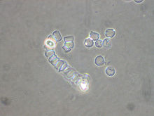 The heterolobosean protozoa species "Acrasis rosea" Olive & Stoian
