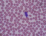 血液の光学顕微鏡写真、多数あり丸く赤く写っているのが赤血球。中央に1つある細胞は白血球、赤血球の間に見える小さなゴミのようなものが血小板である