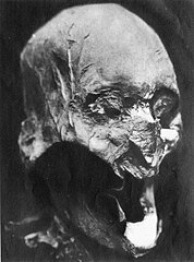 Alleged skull of Henry IV in 1933; his tomb was ransacked during the الثورة الفرنسية. This skull didn't match the DNA of Louis XIII's descendants in 2013. Also, this skull doesn't match Louis XVII's heart on mtDNA. The mtDNA haplogroup of the skull is U5b* 16311T>C.[31]