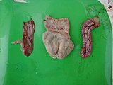 داء نيوكاسل في دجاجة. نمشات في المعدة الغدية والأحشاء (في الوسط)، التهاب حاد للإثني عشر (منظر خارجي في اليمين، منظر للغشاء المخاطي في اليسار).