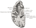 Section of brain showing upper surface of temporal lobe