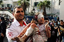 A man carrying a bloodied and bandaged child.