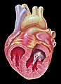 Opened chambers of the heart displaying papillary muscles and chordae tendineae