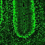 Expression of SLC1A3 in the Bergmann glia fibers. Mouse brain at 7th postnatal day, sagittal section; GENSAT database.