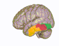 3D view of the fusiform gyrus. Yellow: temporal section, red: occipito-temporal section, green: occipital section