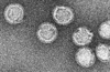 Electron micrograph of tick-borne encephalitis virus