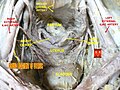 Round ligament of uterus