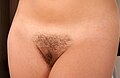 Triangle/American wax" – hair shortened from the sides to form a triangle so that pubic hair is hidden while wearing swimwear