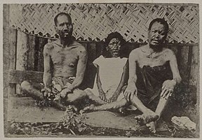 Leprosy in Tahiti, c. 1895